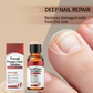 🎄 Promo Noël Éclatante：50% de réduction!🔥🎁Essence réparatrice pour ongles abîmés【2+1 offert】